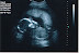 Baby color.jpg
