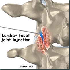 pm_general_fji_lumbar[1]