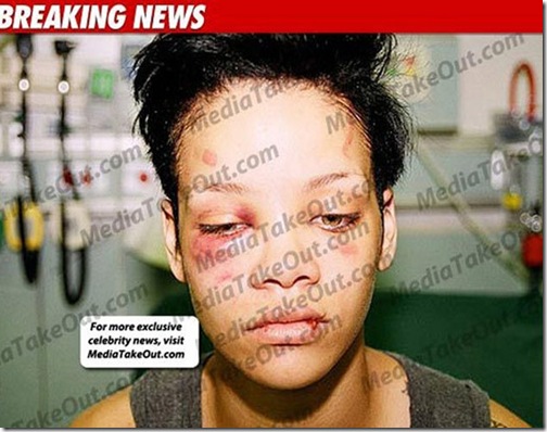 Novas fotos da agressão de Chris Brown em Rihanna 