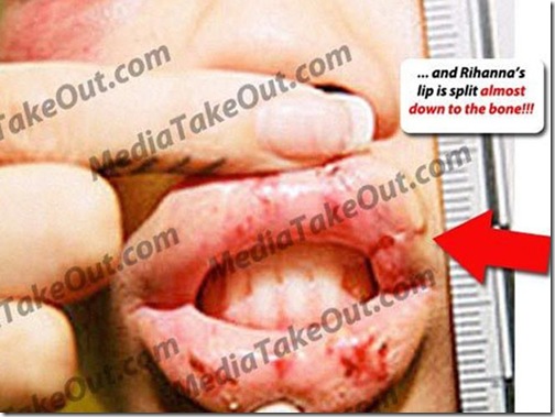 Novas fotos da agressão de Chris Brown em Rihanna