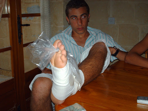 ligament