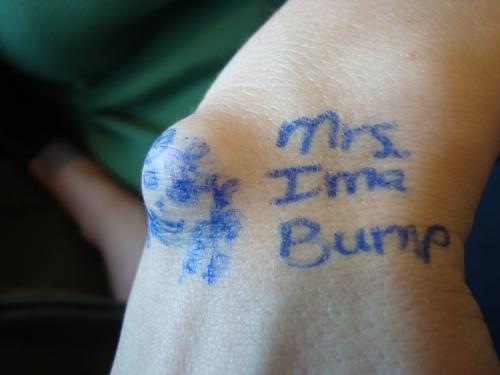 [bump[6].jpg]