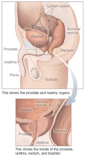The Prostate Illustration of Man's Prostate