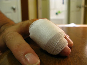 Day One.  Fresh from the Emergency Room and freshly bandaged.
