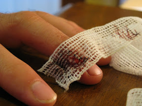 Day Two.  Getting the bandage off was a little tricky.  It had dried to the cut, and it was stuck both to the dried blood, and to the stitches.  Running it under water did the trick though, and cleaned the area a bit to boot.