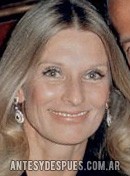 Cloris Leachman, 1972