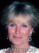 Linda Evans, 1982