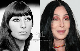 Cher antes y despues de la cirugia plastica