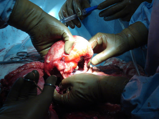 Трансплантация...