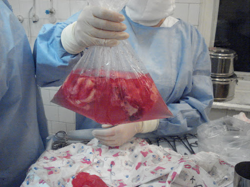 Трансплантация...