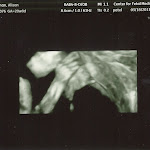 baby_friedman_anatomy_scan_07.jpg