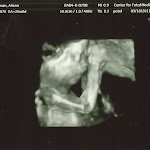 baby_friedman_anatomy_scan_11.jpg