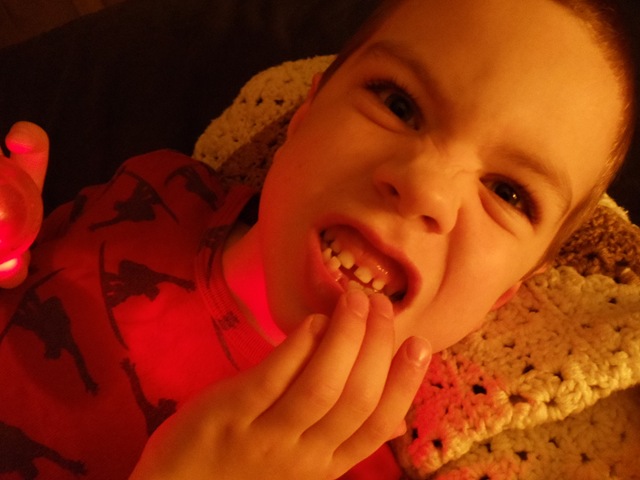 [20100831_TravisLost2ndTooth01[2].jpg]
