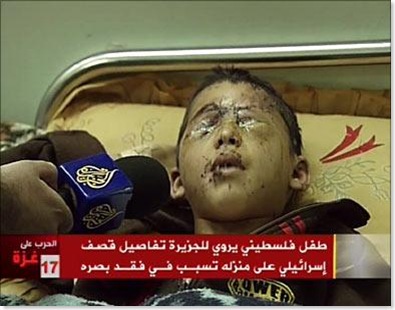 img_4bd72cba82_child_blind_gaza_dime_aljazeera