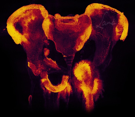 [Pelvis_by_plasticforks[10].jpg]