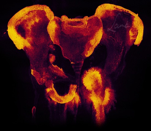 Pelvis_by_plasticforks