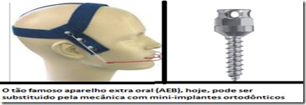 mini_implante_ortodontico vs AEB