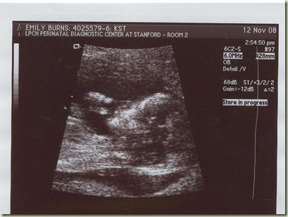 Baby #2 Ultrasound