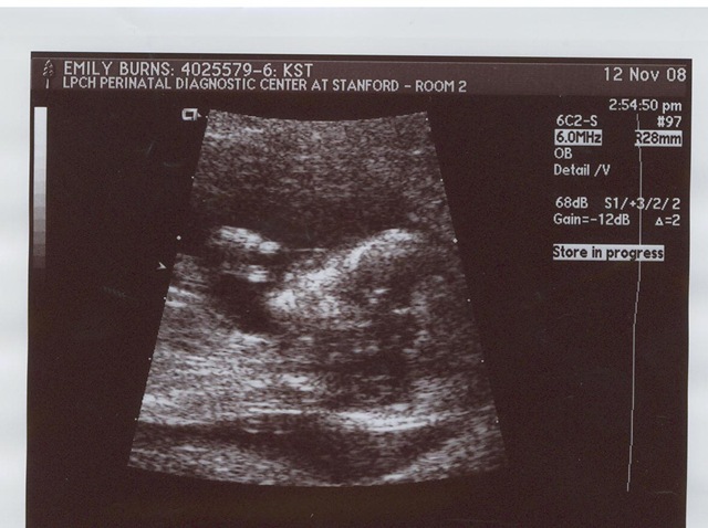 [Baby #2 Ultrasound[4].jpg]