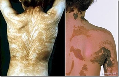 Bizarre_Skin_03 Bizarre_Skin_03