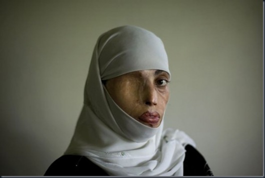 acid_terrorism_01-588x391 acid_terrorism_01-588x391