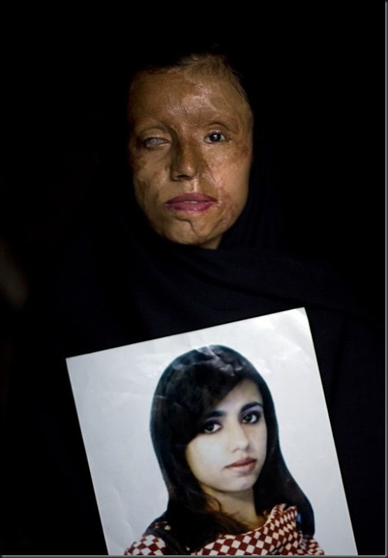 acid_terrorism_12-588x857 acid_terrorism_12-588x857