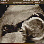 Lincoln-Ultrasound.jpg
