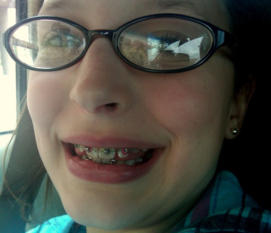 [emma braces[4].jpg]