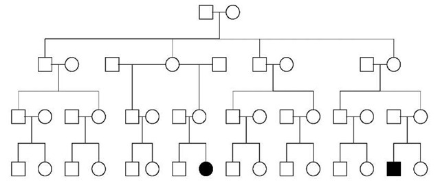 Pedigree with only two second cousins affected out of 30 relatives in a four-generation family. Such pedigrees are frequently assumed to be explained by complex or multifactorial inheritance. Note that this pedigree is also consistent with several other possible mechanisms of inheritance including the following: an unbalanced chromosomal rearrangement where intervening, unaffected relatives carry the balanced rearrangement; autosomal dominant with incomplete penetrance; X-linked inheritance with incomplete penetrance in heterozygous females; and mitochondrial inheritance where expression depends on an environmental exposure such as aminoglycoside-induced deafness (compare with Figure 2) 