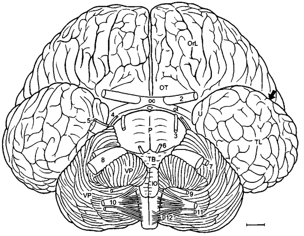 Bottlenose dolphin brain in basal aspect. Arrow pointing into sylvian cleft, ot, optic tract; OT, olfactory tubercle; TL, temporal lobe; U, uncus; VP, ventral paraflocculus; 2-12, cranial nerves; 3, oculomotor nerve; 4, trochlear nerve; 6, abducens nerve; 9, glossopharijngeus nerve; 11, accessory nerve; 12, hypoglossals nerve. Scale: 1 cm. After Langworthy (1932), modified after Pilleri and Gihr (1970) and Morgane and Jacobs (1972). 