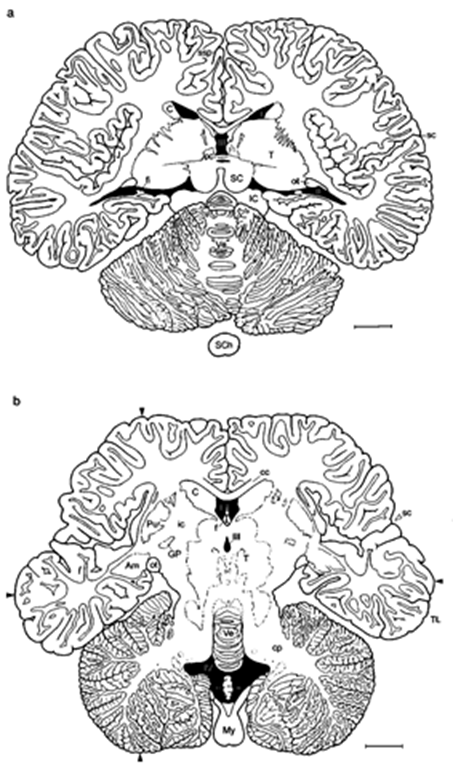 Common dolphin, Delphinus delphis (horizontal sections): (a) through middle of brain and (b) through basal brain. Arrowheads: locations for measu rement of length and width of the brain, ventricular spaces black. Am, amygdaloid body; C, caudate nucleus; cp, cerebellar peduncles; ft, fimbria; GP, globus pallidus; J, insula; ic, internal capsule; Pu, putamen; sc, sylvian cleft; SCh, spinal cord; ssp, suprasplenial (limbic) sulcus; I-IV, ventricles. Scale: 1 cm. Modified after Pilleri et al. (1980). 