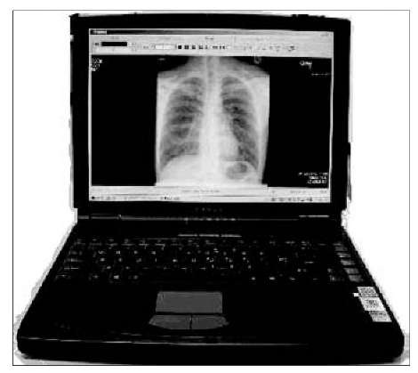 A laptop computer for teleradiology