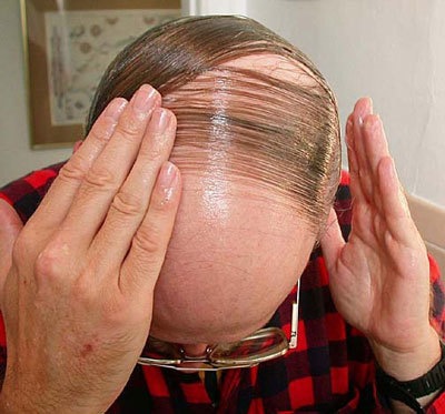 [Pojt 0062 001 O hirxutijmo e a belhixe[6].jpg]
