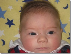 Baby A