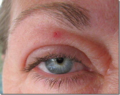 Dog Have Eye Swollen Dog Have Eye Swollen