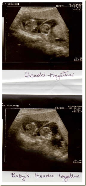heads together