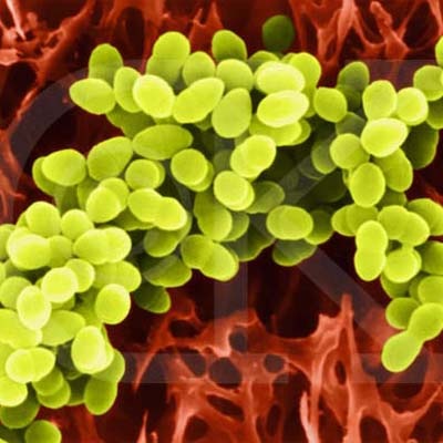 [staphylococcus-aureus[10].jpg]