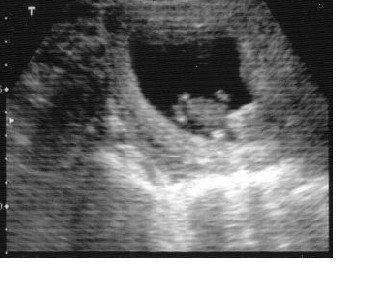 [baby[3].jpg]