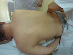 Spondylosis and hip pain