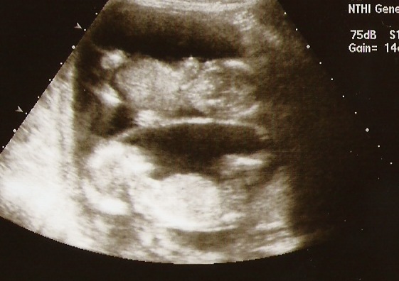 [babies 14 weeks[6].jpg]
