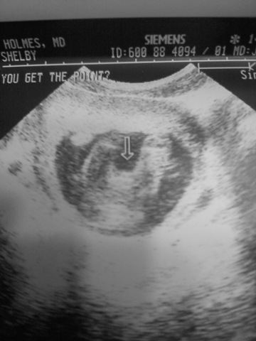 [baby boy weight2[5].jpg]