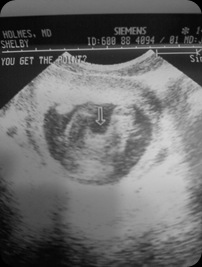 baby boy weight2