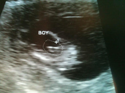 13+weeks+pregnant+ultrasound+gender