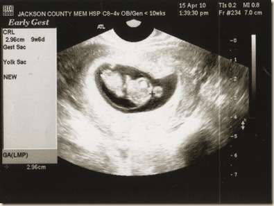 New Baby 10 weeks New Baby 10 weeks