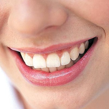01-teeth-whitening-make teath healthy