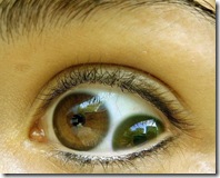 bizarre-eyes2
