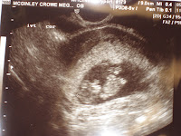 First Ultrasound!