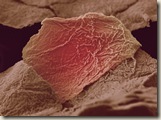 Skin-cells-from-a-scald