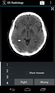 How to get Radiology Flashcards: ER 1.4 mod apk for pc