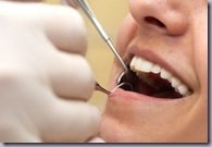 dental cleaning